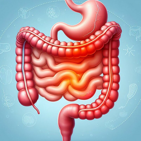 Illustration of an inflamed gut showing redness and swelling in the digestive tract